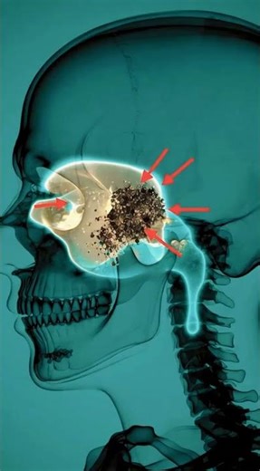 You Think It’s Just a Stye… Here’s What’s Actually Happening Inside #medicalscience #humanbody