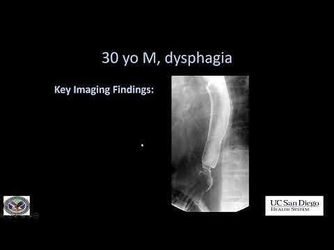 Imaging of esophagus