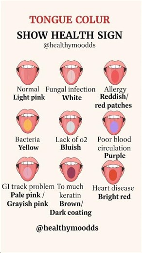 "Tongue Colour & Your Health: What your tongue Reveals about your body"#tonguehealth #tongue #health