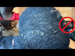 Bad haircut flakes!!!!!