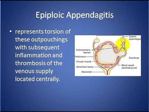 Epiploic Appendagitis