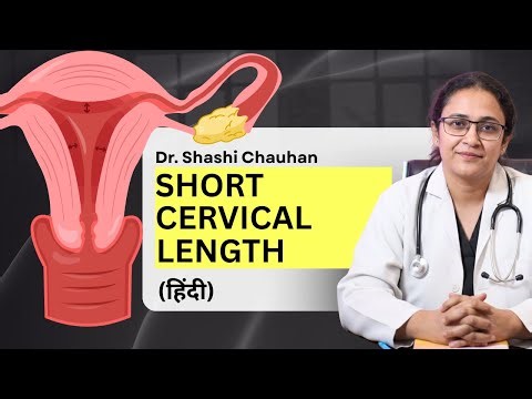 What is short cervical length during pregnancy? #pregnant #cervix #cervical #pregnancy #gynecology