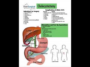 Gallbladder removal