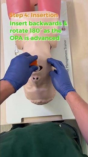 Master Oropharyngeal Airway Insertion Techniques #oropharyngealairway