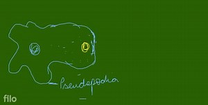 Egestion is the process of elimination of undigested solid part... | Filo