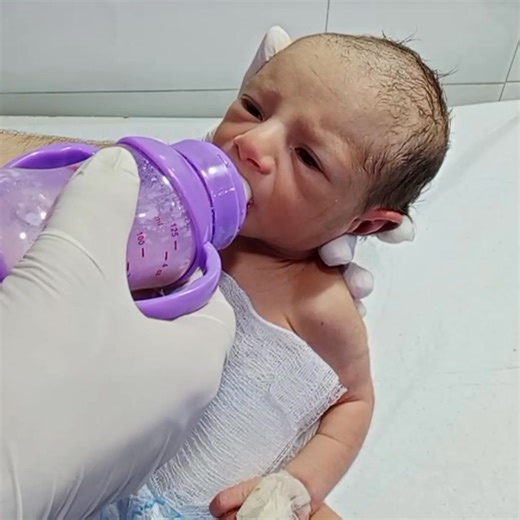 Feeding a newborn baby correctly is one of the most important parts of early care. 🍼👶 In this video, we explain step by step how to feed a baby safely, including proper positions, techniques, and NICU guidance. In this video: ✅ How to feed a baby safely ✅ Best feeding positions for newborns ✅ Burping techniques after feeding ✅ Feeding care for preterm or low birth weight babies This video is shared for educational purposes and not for substitute.Always consult a pediatric #nicubabyfeeding #pre