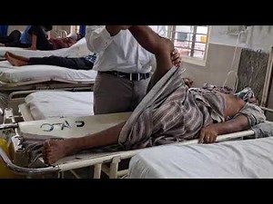 signs of meningitis.... kernig's and brudzinski's sign