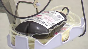 Valley hospitals may delay surgeries due to extreme blood shortage