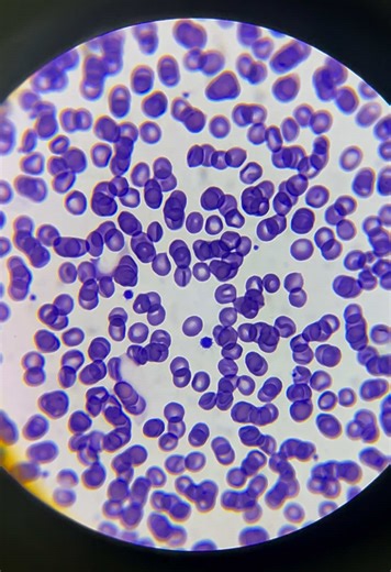 Glóbulos Rojos en Acción: Un Viaje al Microscopio