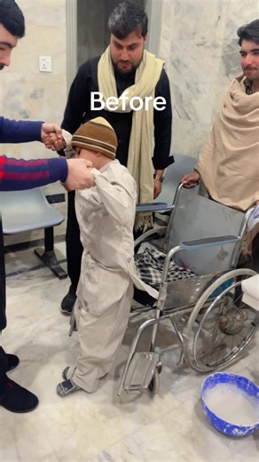 Transformative Rehab Journey: Before and After