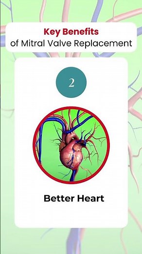 Key Benefits of Mitral Valve Replacement