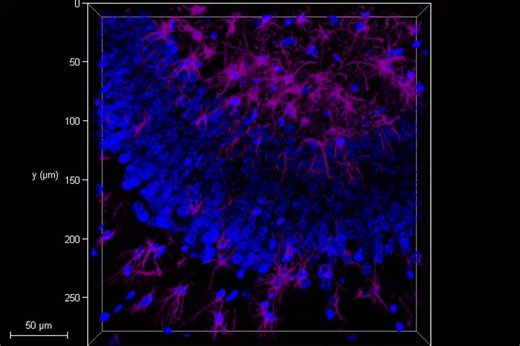 Astrocytes (GFAP, magenta) are abundantly distributed within the neurogenic niche of the hilus, while being comparatively sparse in the granule cell layer (dense DAPI, blue) as well as the ones… | Oveis H. Sahafi