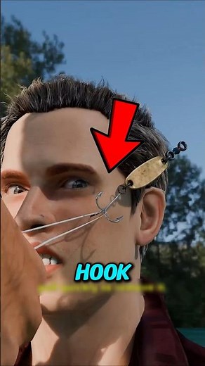 Have You Ever Wondered How to Remove a Fish Hook Safely?
