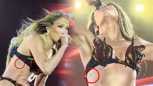 Jennifer Lopez removes tattoo tribute to Ben Affleck a year after marriage split