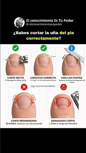 ¿Sabes cortar la uña del pie correctamente
