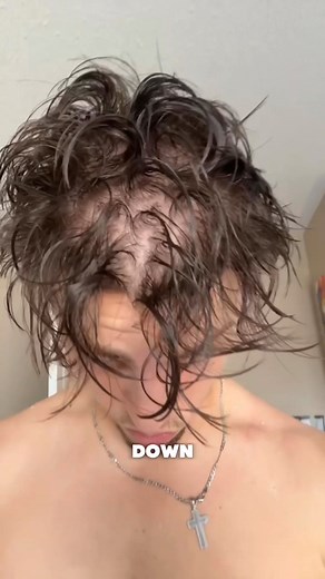 $880 → $21/Month. Limited-Time Offer. We will never do this again. Tired of losing hair? You’re not alone. 🧑‍🦲 Meet the breakthrough in hair regrowth — AlphaInfuse Hair Regrowth System. No side effects. No harsh chemicals. Just pure science restoring your hair back. Formulated for men like you battling hair loss. Our blend of Licorice Root Extract, Ginger Root, Black Sesame, and Citric Acid attacks the root cause of thinning. With micro-infusion technology, nutrients penetrate deep into the fo