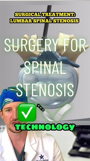 Spinal Stenosis Surgery Explained: Laminectomy & Fusion