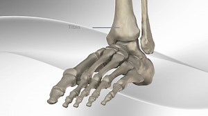 Ankle Fracture Repair with Arthrex® Fracture Management System
