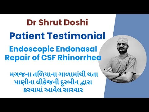 CSF Rhinorrhea - Endoscopic Endonasal Repair - Patient Testimonial - Dr Shrut Doshi