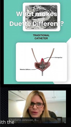What Makes Duette Catheter Different