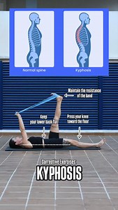 20K views · 1.9K reactions | Kyphosis is a postural condition where...
