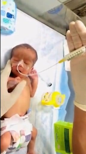 6K views · 74 reactions | HOW TO ADMINISTER NG TUBE FEEDING TO A NICU...