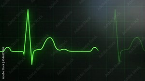 Loop EKG Heart Rate In Normal Sinus Rhythm. Green Beat Line On The Monitor. Graph Of Electrical Activity Related To The Cardiac Contractions And Grid Scale With Axes For The Interpretation Of ECG Wave