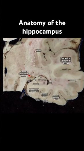 Anatomy of the hippocampus #anatomy #doctor #science #neuroscience #usmle
