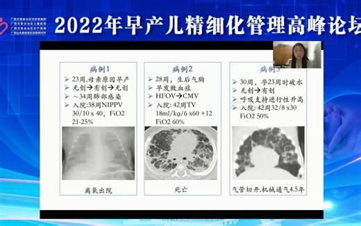 SBPD综合管理