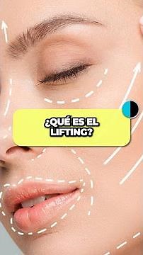 💆‍♀️✨ Descubre qué es el Lifting y cómo funciona