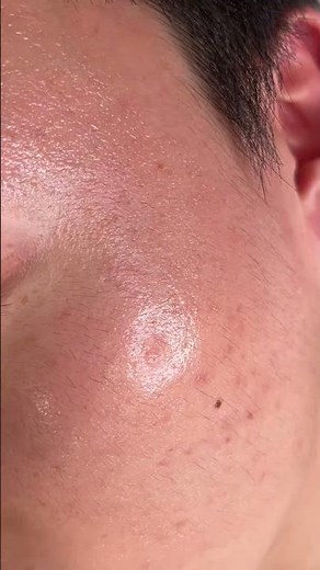 피부톤업 효과 레전드 #창원왁싱 #waxing #남자 #뷰티꿀팁