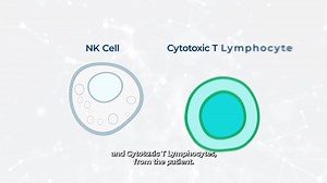 Lymphocyte-Activated Killer (LAK) Cell Therapy is a supportive immunotherapy used within the ImPACT Program (Immune Personalized Autologous Cell Therapy) at Oasis of Hope. LAK therapy involves collecting a patient’s own lymphocytes (a type of white blood cell), stimulating them with interleukin-2 (IL-2), and reinfusing them to enhance immune activity. These activated cells circulate in the body and help recognize abnormal cells, supporting the immune system’s overall response to cancer. This vid
