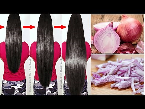 How To Grow Long and Thicken Hair Faster With Onion & Potato | Super fast Hair Growth Challenge