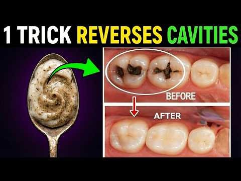 Receding Gums? #1 Secret Reverses Cavities Naturally