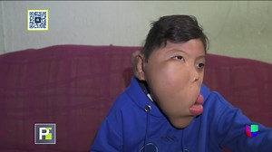 688K views · 24K reactions | #AyudaDeImpacto: Este niño nació con una...