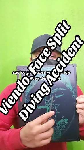 Viendo: :Face Split Diving Accident