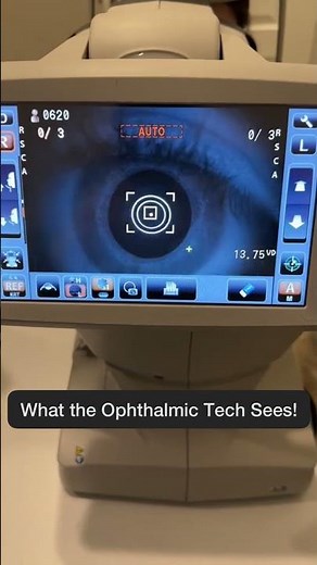 What We SEE vs What You SEE #eyetest #autorefractor #eyecare