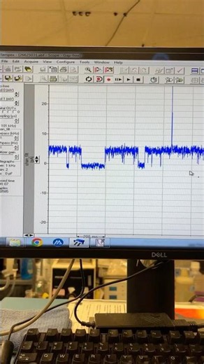 见证奇迹的时刻：记录到5pA单个离子通道电流！Inside-out Single-Channel Patch-Clamp Recording！