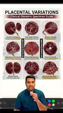 Placental Variations Explained | Types of Placenta in Obstetrics | Nursing Officer Exam 2026