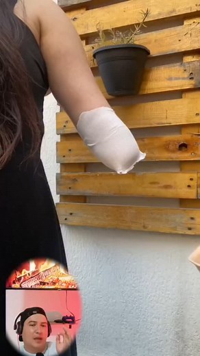 Protesis de brazo 🥹 | Gustavito payàn