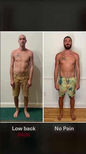 Lateral Pelvic Shift