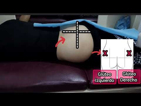 Quadrant division for intramuscular injection in the gluteus 🍑💉