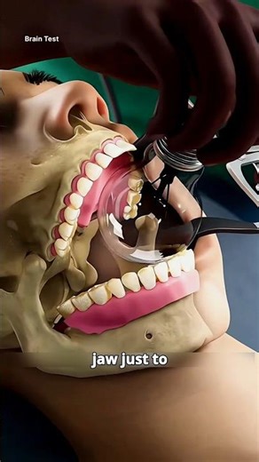 The "Bright Idea" That Required a Surgeon