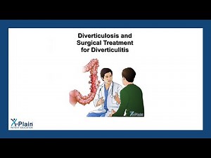 Diverticulosis and Surgical Treatment for Diverticulitis