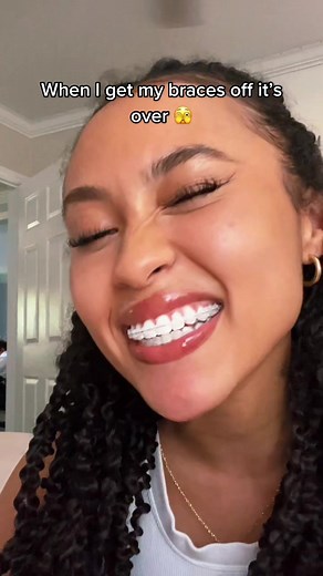 Achieving the Perfect Smile: Braces Off Before Prom