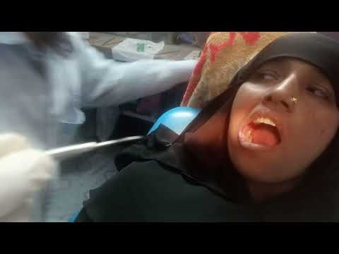 “Gum Surgery + Build-Up | Third Molar Treatment | Instant Pain Relief | Jakia Dental Hall”