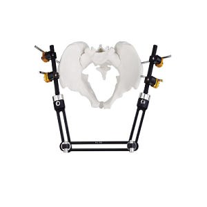 [Hot Item] Surgical Instruments Orthopedic Fixationpelvic External Fixator-Combination Three