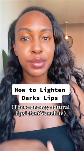 How to lighten dark lips & lip pigmentation. #darklips #hyperpigmentation #lippigmentation