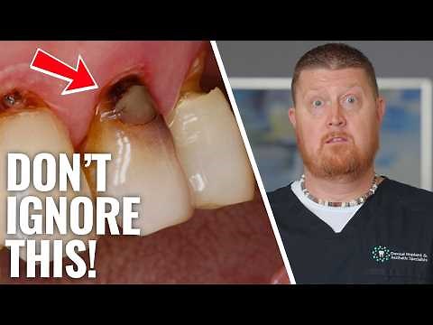 How to Tell If a Tooth Is Rotten or Infected (and How It Affects Your Body)