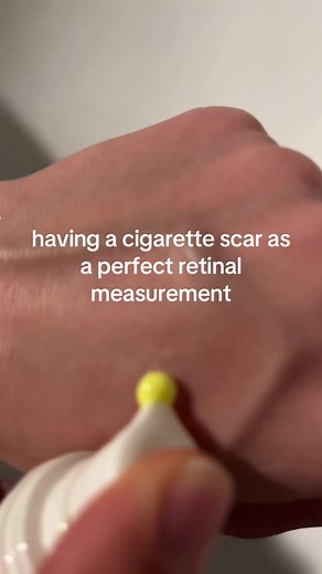 Estheticians' Dream: Cigarette Scars and Retinal Marking